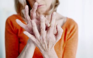 Frau mit Rheumaschmerzen in den Fingergelenken